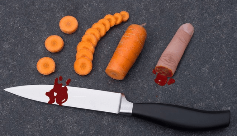 Accidentes en el hogar aumentan en 2018